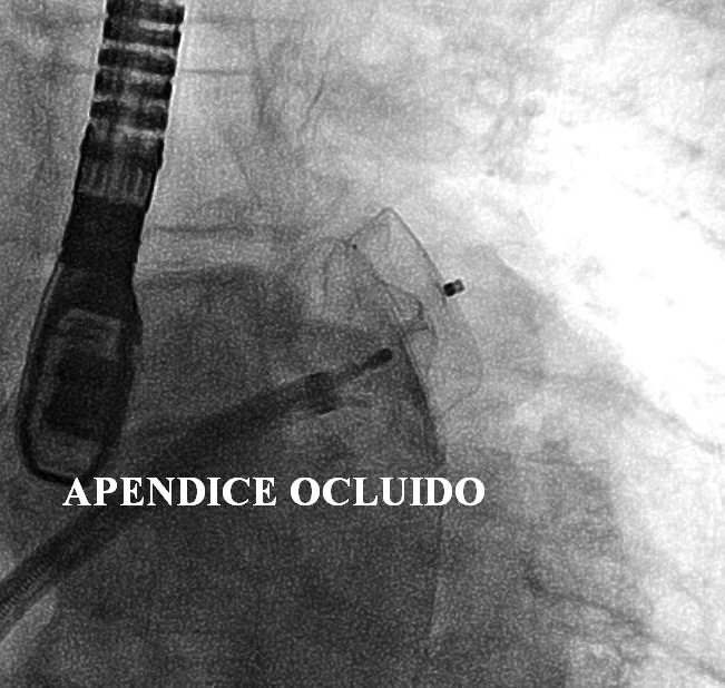 FECHAMENTO